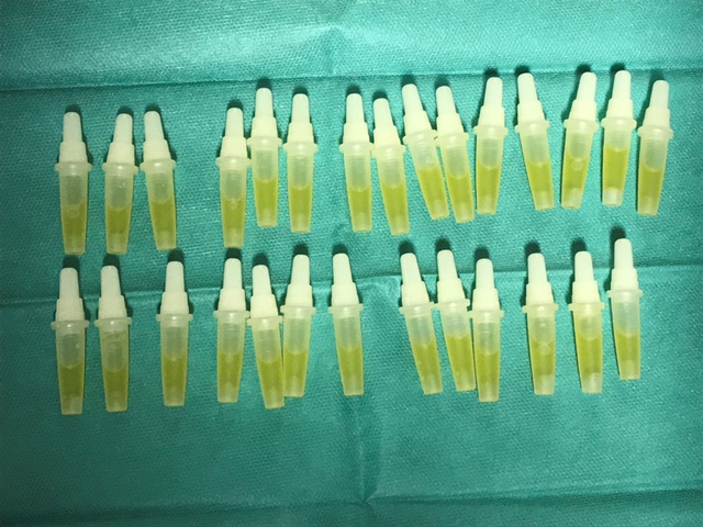 Alignement de flacons compte-gouttes pour illustrer le nouveau traitement ophtalmologique PRGF Endoret